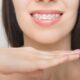 Come funziona l’apparecchio ortodontico?